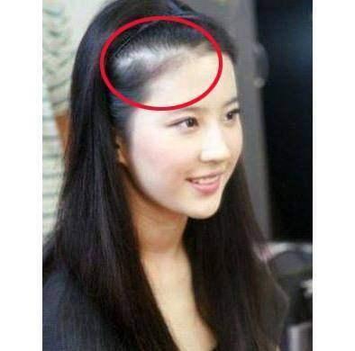 女明星也会脱发吗,美丽背后的健康挑战